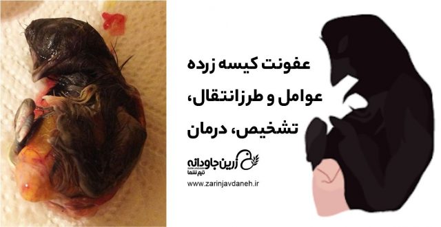 عفونت کیسه زرده