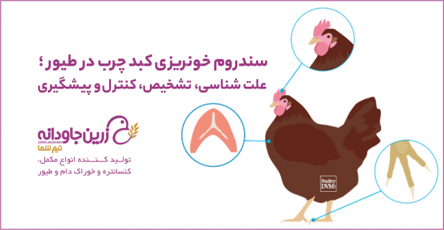 سندرم خونریزی کبد چرب