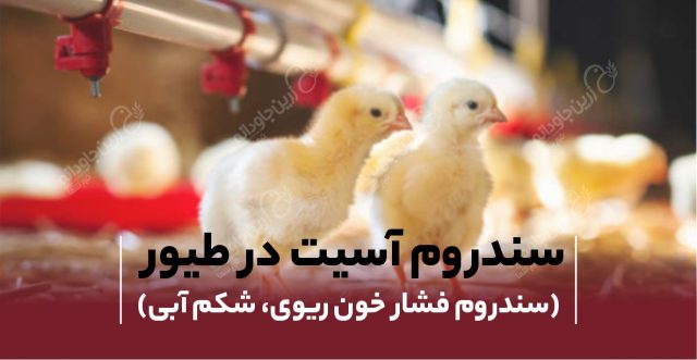 سندروم آسیت