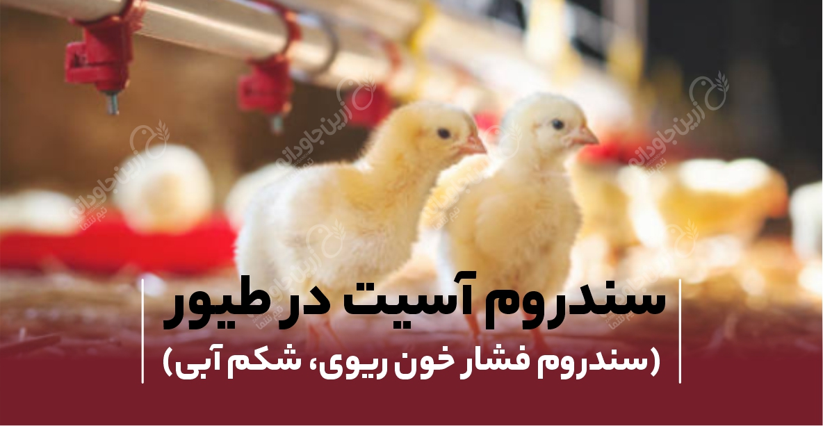 سندروم آسیت